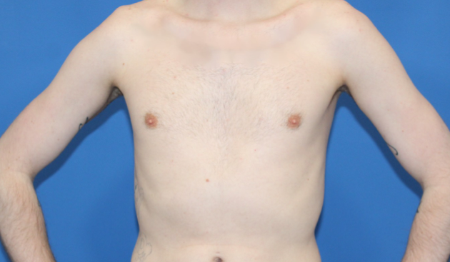 Patient Case #016