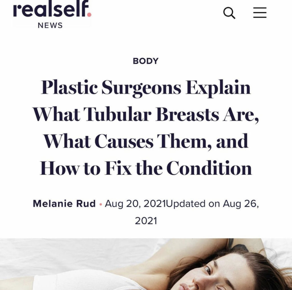 REalsealf: tubular breasts