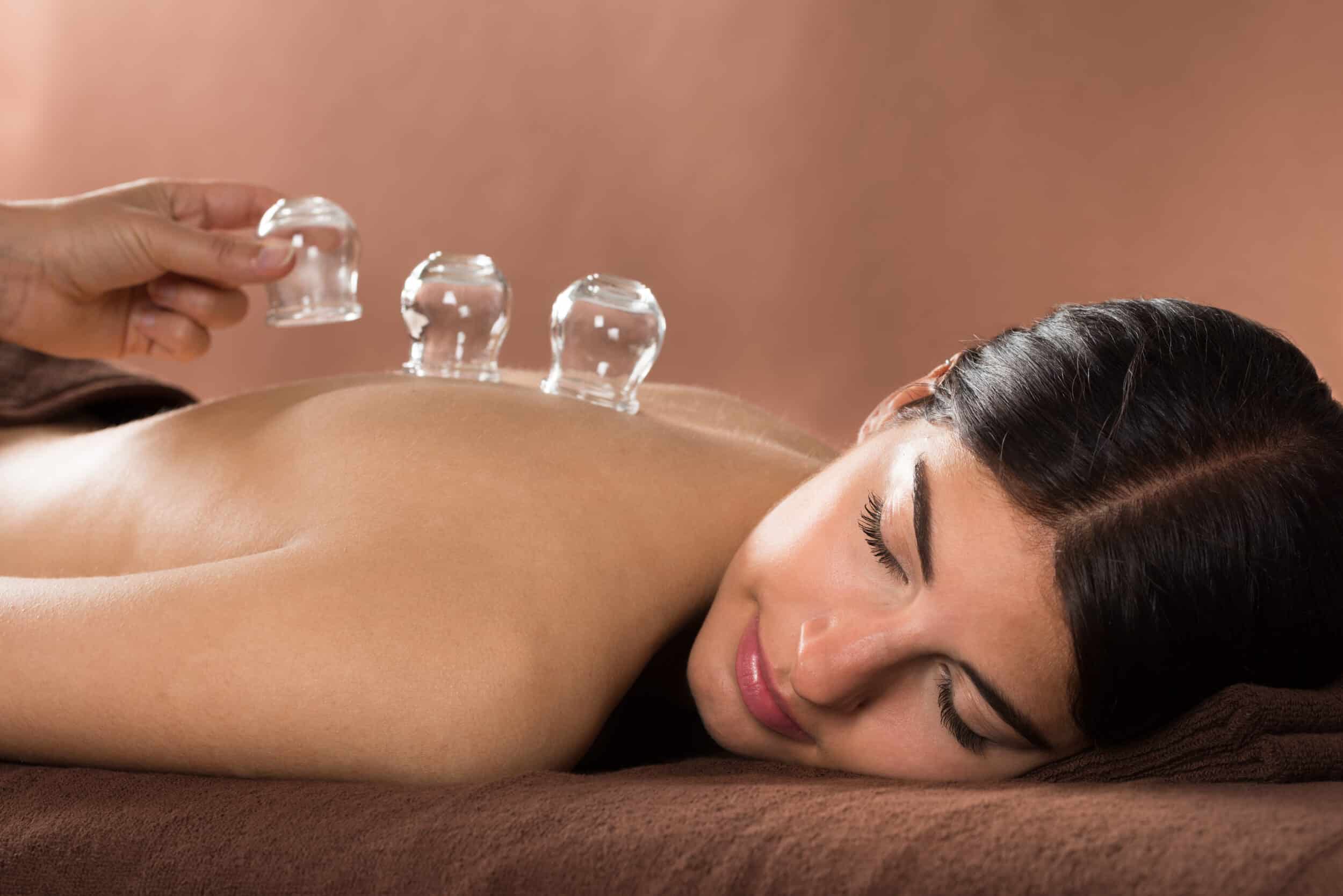 Woman,Lying,On,Front,Receiving,Cupping,Treatment,On,Back