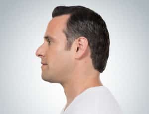 Kybella, Somenek + Pittman MD, Washington D.C.