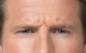 Botox, Somenek + Pittman MD, Washington D.C.