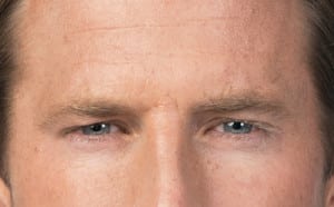 Botox, Somenek + Pittman MD, Washington D.C.