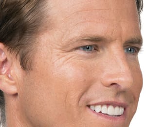 Botox, Somenek + Pittman MD, Washington D.C.