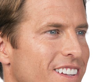 Botox, Somenek + Pittman MD, Washington D.C.