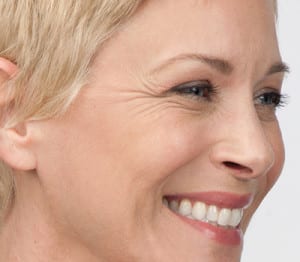 Botox, Somenek + Pittman MD, Washington D.C.