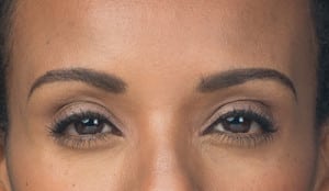 Botox, Somenek + Pittman MD, Washington D.C.