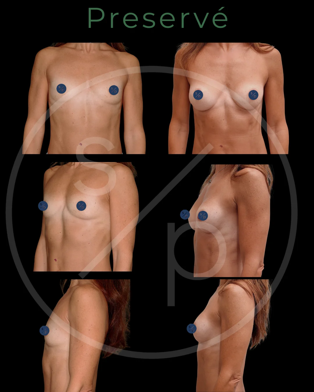 17199-p14-1-preserve
